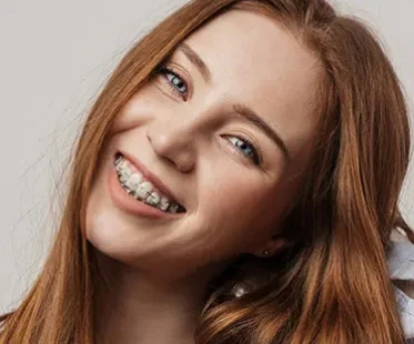 Clear Braces Small