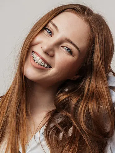 Clearbraces Clearbraces