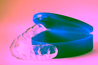 Retainers Retainers